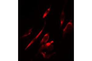 ABIN6274289 staining HeLa cells by IF/ICC. (MAPK10 Antikörper  (C-Term))