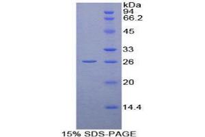SDS-PAGE (SDS) image for Peptidylprolyl Isomerase D (PPID) (AA 7-206) protein (His tag) (ABIN1879254) (PPID Protein (AA 7-206) (His tag))