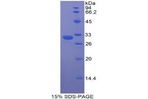 SDS-PAGE analysis of Rat CPB2/TAFI Protein. (CPB2 Protein)