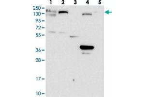 Western blot analysis of Lane 1: RT-4, Lane 2: U-251 MG, Lane 3: Human Plasma, Lane 4: Liver, Lane 5: Tonsil with GOLGA3 polyclonal antibody  at 1:100-1:250 dilution. (Golgin A3 Antikörper)