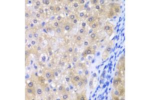 Immunohistochemistry of paraffin-embedded human liver injury using GPX4 antibody (ABIN6294188) at dilution of 1:200 (40x lens). (GPX4 Antikörper)