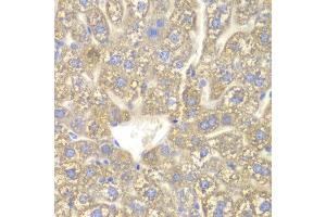 Immunohistochemistry of paraffin-embedded mouse liver using CYP2C18 antibody at dilution of 1:100 (x400 lens). (CYP2C18 Antikörper)