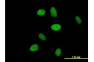 Immunofluorescence of purified MaxPab antibody to NR6A1 on HeLa cell.