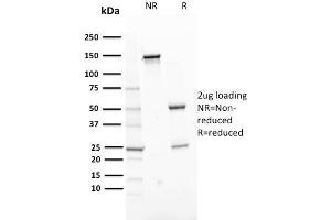 SDS-PAGE Analysis Purified ERCC1 Mouse Monoclonal Antibody (ERCC1/2318). (ERCC1 Antikörper  (AA 191-281))