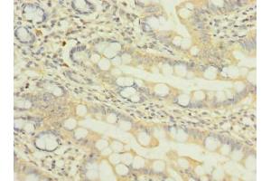 Immunohistochemistry of paraffin-embedded human small intestine tissue using ABIN7162022 at dilution of 1:100 (NUPL1 Antikörper  (AA 211-480))