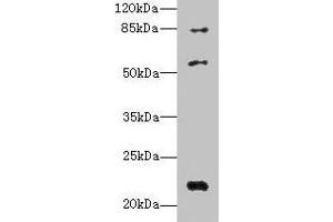 Western blot All lanes: PYHIN1 antibody at 6 μg/mL + Mouse small intestine tissue Secondary Goat polyclonal to rabbit IgG at 1/10000 dilution Predicted band size: 56, 55, 52, 51, 27, 26 kDa Observed band size: 56, 22, 84 kDa (PYHIN1 Antikörper  (AA 1-245))