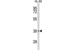 Western Blotting (WB) image for anti-Peroxisomal Biogenesis Factor 14 (PEX14) antibody (ABIN3004052) (PEX14 Antikörper)