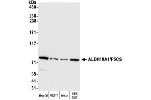 Western Blotting (WB) image for anti-Aldehyde Dehydrogenase 18 Family, Member A1 (ALDH18A1) (AA 575-625) antibody (ABIN7449868) (P5CS Antikörper  (AA 575-625))
