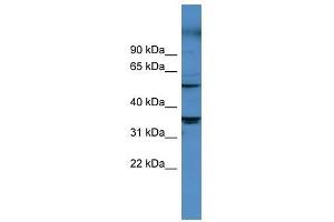 CYP11B1 antibody used at 0. (CYP11B1 Antikörper  (Middle Region))