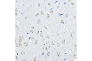 Immunohistochemistry of paraffin-embedded rat brain using IDS Rabbit pAb (ABIN3015633, ABIN3015634, ABIN3015635 and ABIN6218988) at dilution of 1:200 (40x lens). (IDS Antikörper  (AA 34-290))