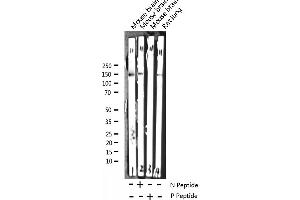 Western blot analysis of Phospho-Trk B (Tyr705) expression in various lysates (TRKB Antikörper  (pTyr706))