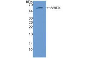 Western blot analysis of recombinant Mouse GbA. (GBA Antikörper  (AA 255-509))