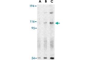 Western blot analysis of ERN1 in A-20 cell lysate with ERN1 polyclonal antibody  at (A) 0.