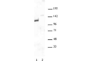 Androgen Receptor antibody (pAb) tested by Western blot. (Androgen Receptor Antikörper  (N-Term))