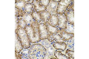 Immunohistochemistry of paraffin-embedded mouse kidney using MMP9 antibody (ABIN7268426) at dilution of 1:100 (40x lens).