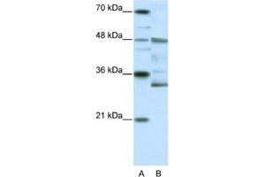 Western Blotting (WB) image for anti-Forkhead Box N2 (FOXN2) antibody (ABIN2461648) (FOXN2 Antikörper)