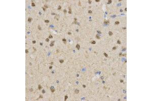 Immunohistochemistry (IHC) image for anti-Transducin-Like Enhancer of Split 1 (E(sp1) Homolog, Drosophila) (TLE1) antibody (ABIN1876687) (TLE1 Antikörper)