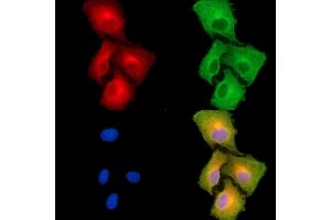 ABIN7094990 and ABIN7099046 staining  cells by IF/ICC. (PRPS2 Antikörper)