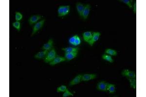 Immunofluorescence staining of HepG2 cells with ABIN7170398 at 1:213, counter-stained with DAPI. (SNX5 Antikörper  (AA 7-245))