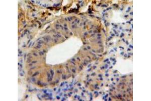 Used in DAB staining on fromalin fixed paraffin-embedded Lung tissue (IL-18 Antikörper  (AA 36-192))