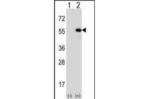 Western blot analysis of DNAJA1 (arrow) using rabbit polyclonal DNAJA1 Antibody (Center) (ABIN652030 and ABIN2840506). (DNAJA1 Antikörper  (AA 294-323))