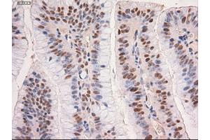 Image no. 3 for anti-Myc Proto-Oncogene protein (MYC) antibody (ABIN1497013) (c-MYC Antikörper)