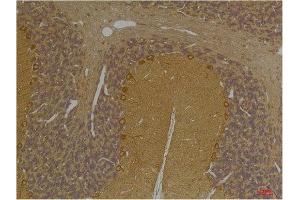 Immunohistochemistry (IHC) analysis of paraffin-embedded Rat Brain Tissue using SLC12A4 Rabbit Polyclonal Antibody diluted at 1:200. (SLC12A4 Antikörper)