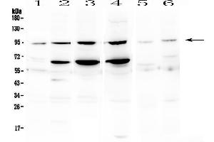Western blot analysis of STAT1 using anti- STAT1 antibody .
