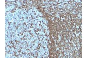 Immunohistochemical staining (Formalin-fixed paraffin-embedded sections) of human tonsil with ICAM3 monoclonal antibody, clone ICAM3/1019 . (ICAM-3/CD50 Antikörper)