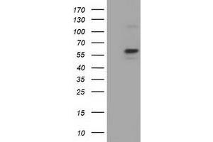 Western Blotting (WB) image for anti-Pyruvate Kinase, Liver and RBC (PKLR) antibody (ABIN1500248) (PKLR Antikörper)
