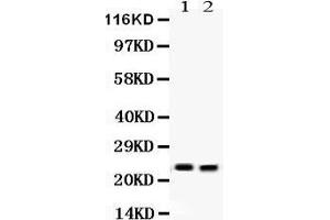 Lipocalin 2 Antikörper  (AA 21-198)