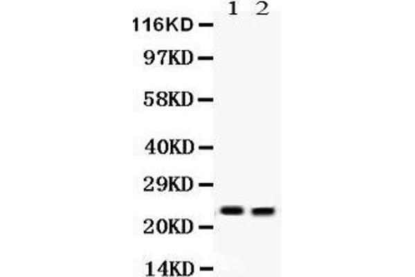 Lipocalin 2 Antikörper  (AA 21-198)