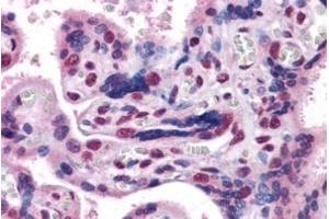 ABIN5867149 (3. (GBX2 Antikörper)