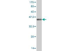 Western Blot detection against Immunogen (36. (NUDT5 Antikörper  (AA 120-219))