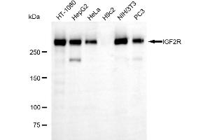 Western blotting analysis using IGF2R antibody (ABIN7799053). (Rekombinanter IGF2R Antikörper)
