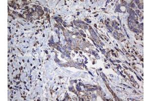 Image no. 7 for anti-NADH Dehydrogenase (Ubiquinone) 1 beta Subcomplex, 10, 22kDa (NDUFB10) antibody (ABIN1499672) (NDUFB10 Antikörper)