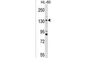 TMC5 Antibody (Center) (ABIN1538112 and ABIN2849569) western blot analysis in HL-60 cell line lysates (35 μg/lane). (Tmc5 Antikörper  (AA 222-251))