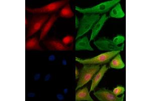 Phospho-TAO2 (Ser181) Antibody staining A549 cells(H2O2 treatment) by IF/ICC. (TAO Kinase 2 Antikörper  (pSer181))