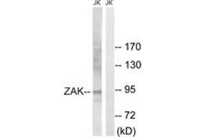 Western blot analysis of extracts from Jurkat cells, using ZAK (Ab-165) Antibody.