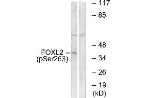 Western blot analysis of extracts from K562 cells, treated with Na3VO4 (0. (FOXL2 Antikörper  (pSer263))