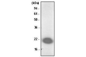 Jurkat cell lysate was resolved by SDS-PAGE, transferred to PVDF membrane and probed with anti-human Park7/DJ-1 antibody (1:1000). (PARK7/DJ1 Antikörper  (AA 1-189))