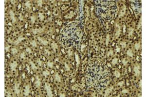 ABIN6273754 at 1/100 staining Mouse kidney tissue by IHC-P. (PIK3C2B Antikörper  (Internal Region))