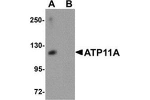 Western blot analysis of ATP11A in K562 cell tissue lysate with ATP11A antibody at 1 μg/ml in (A) the absence and (B) the presence of blocking peptide. (ATP11A Antikörper  (N-Term))