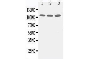 Anti-Zonula occludens protein 3 antibody, Western blotting Lane 1: PANC Cell Lysate Lane 2: A549 Cell Lysate Lane 3: HELA Cell Lysate