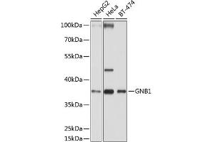 Western blot analysis of extracts of various cell lines, using GNB1 antibody (ABIN6129389, ABIN6141219, ABIN6141220 and ABIN6219000) at 1:1000 dilution. (GNB1 Antikörper  (AA 1-340))