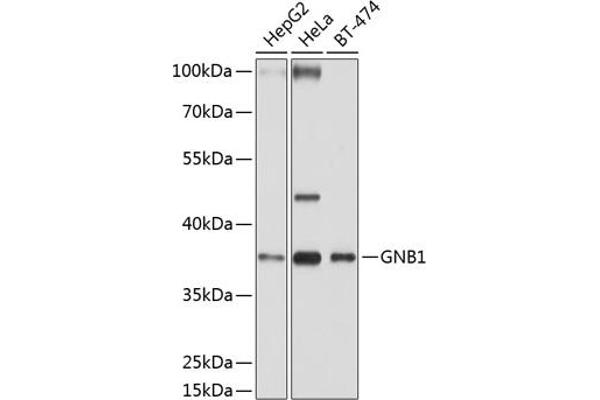 GNB1 Antikörper  (AA 1-340)