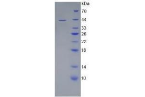 SDS-PAGE (SDS) image for CD4 (CD4) ELISA Kit (ABIN6730914)