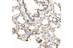 Immunohistochemistry of paraffin-embedded rat lung using [KO Validated] MyD88 Rabbit mAb (ABIN7268723) at dilution of 1:1000 (40x lens). (MYD88 Antikörper)