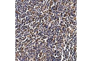 Immunohistochemistry of paraffin-embedded human tonsil using C Rabbit pAb (ABIN6130035, ABIN6137891, ABIN6137892 and ABIN6220925) at dilution of 1:100 (40x lens). (CAMK4 Antikörper  (AA 304-473))