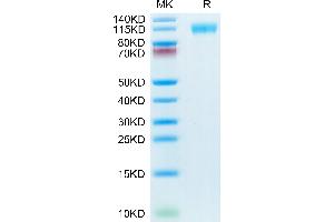 SARS-COV-2 Spike S1 (N501Y,K417N,E484K) on Tris-Bis PAGE under reduced condition. (SARS-CoV-2 Spike S1 Protein (E484K, K417N, N501Y) (His tag))